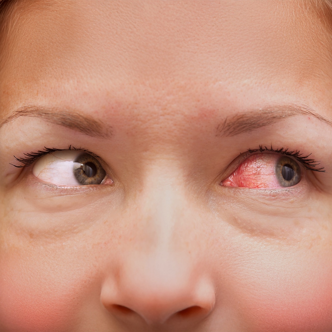 Rote Augen der Frau werden gezeig